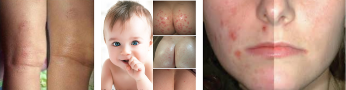 Winter can often bring out the worst in Skin